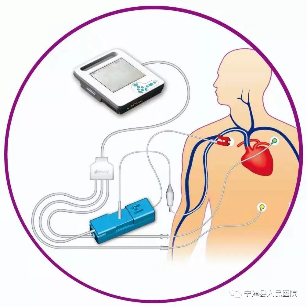 患者福音神奇的心电图定位技术