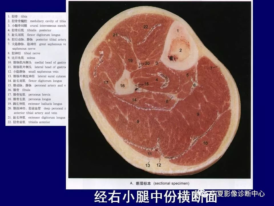 后腰部肌肉断层解剖图图片