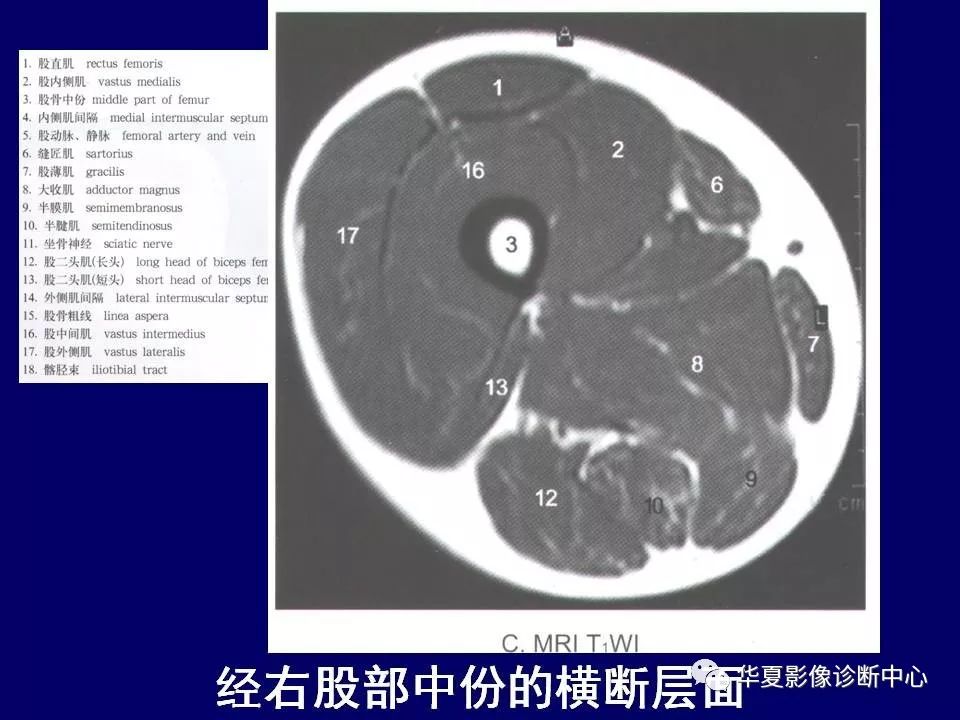 下肢的断层解剖