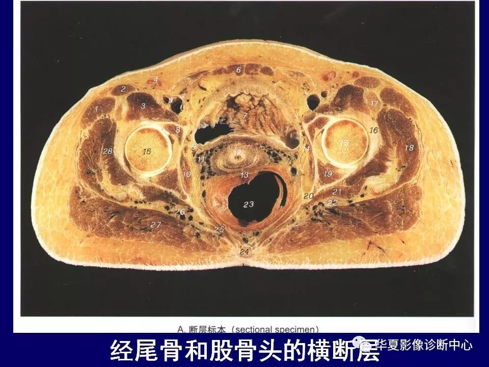 下肢的断层解剖