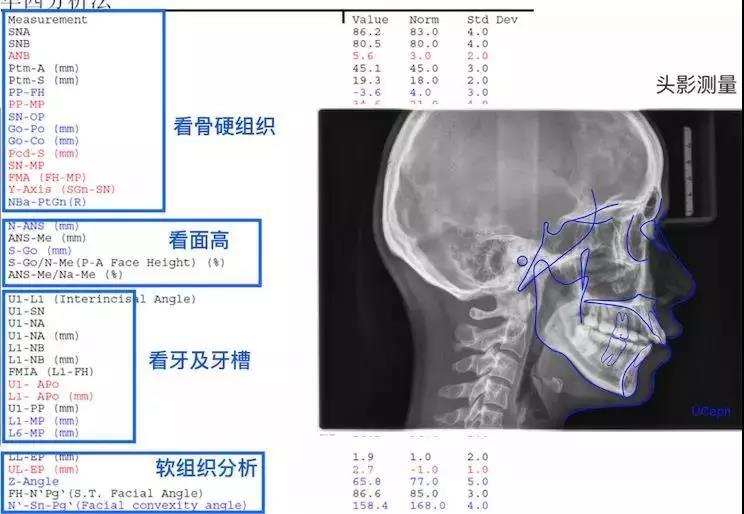 牙医vs顾客眼中的正畸,差别这么大!