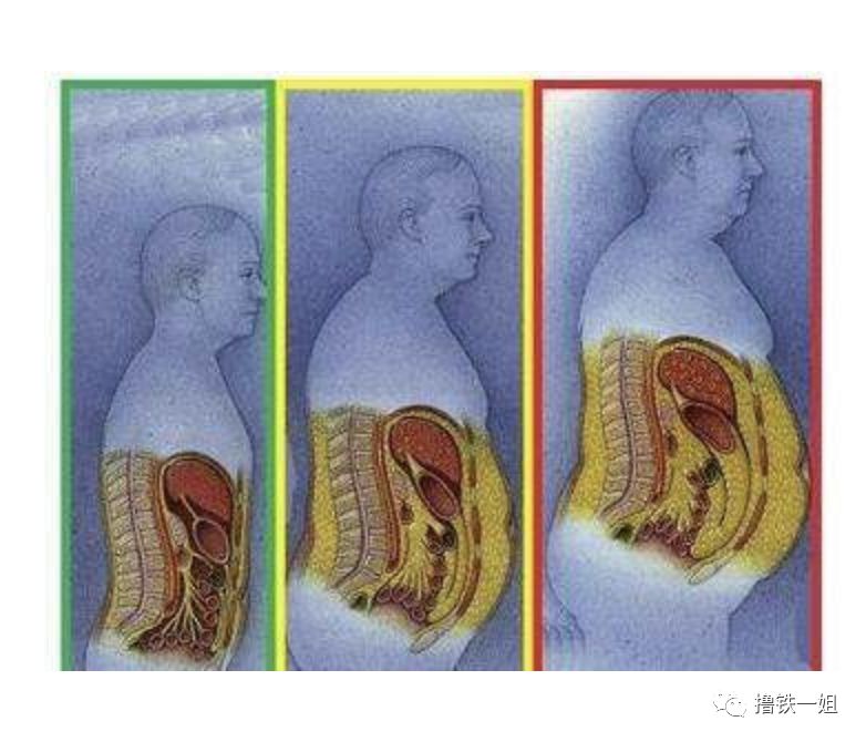 皮下脂肪厚了点,可能就是体型不太美观,内脏脂肪是更可怕的健康杀手.