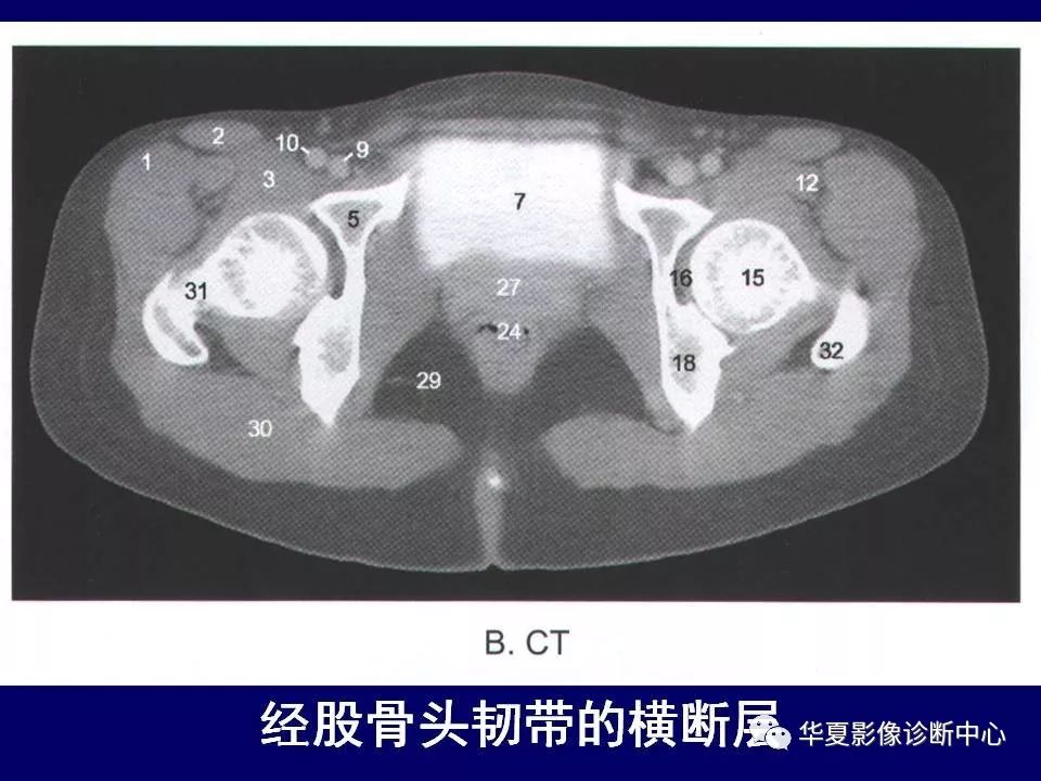 下肢的断层解剖