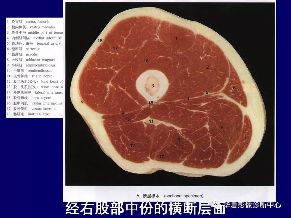 大腿肌肉横断位解剖图图片