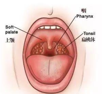口腔扁桃体正常图片图片