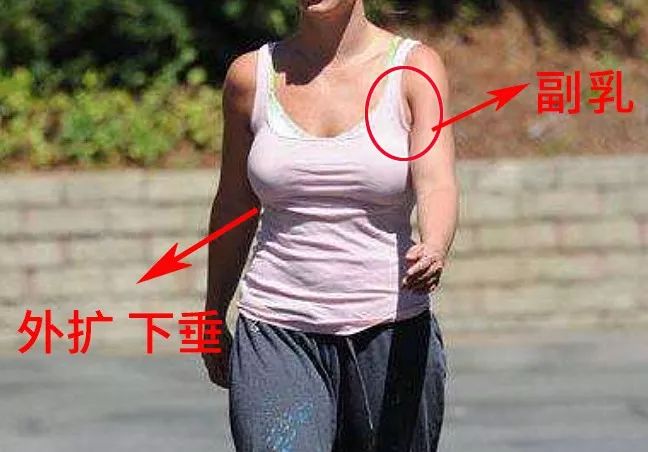 但塑形能力很差 经常穿会导致胸部外扩,副乳,下垂 生过孩子,上了年纪