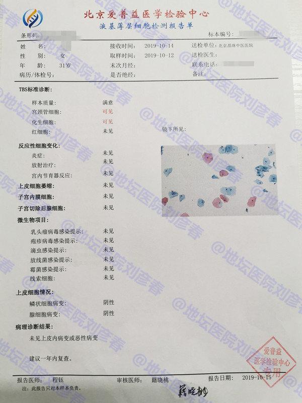 tct檢測已無異常,十月份複查hpv為陰性,tct也沒有問題,整個治療過程中