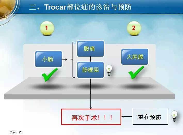 腹腔镜trocar位置图片