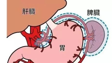 慢性肾炎辨证分型若病至后期,与脾肾的关系尤为密切,此时脾阳虚衰证与