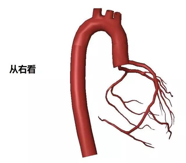 这些图帮你认清冠心病和冠状动脉拿走不谢