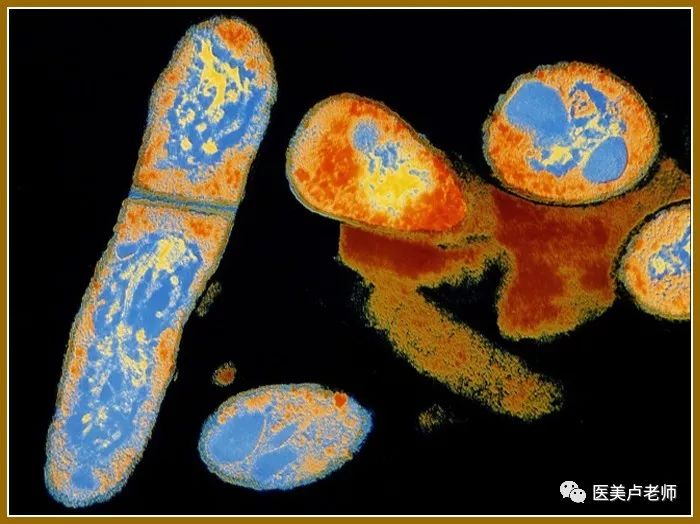 非结核分枝杆菌(nontuberculosismycobacteria)是指除结核分枝杆菌,牛