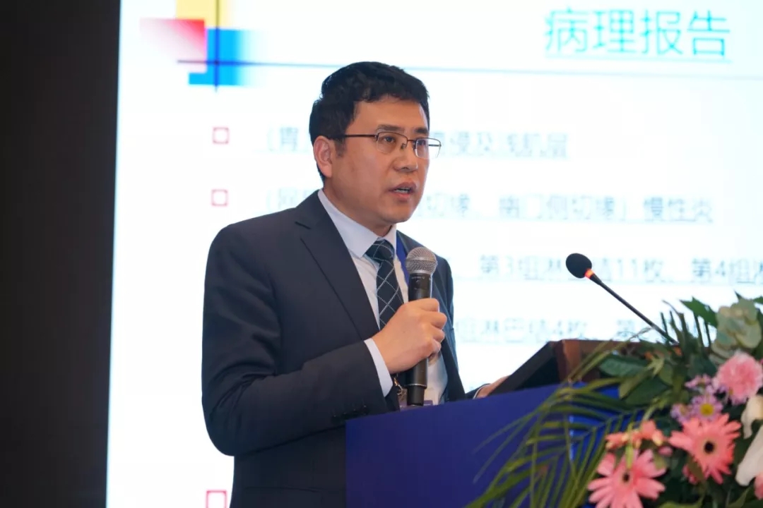 4k腹腔镜胃癌根治术胰腺上区淋巴清扫陆军军医大学西南医院赵永亮教授