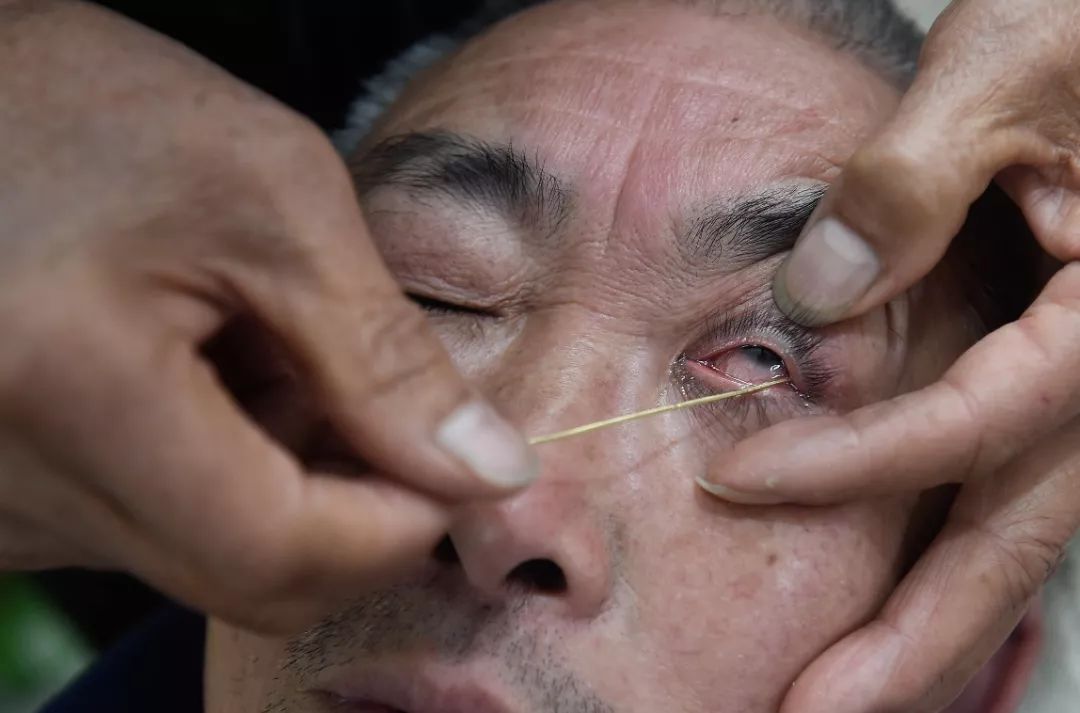 利刃直抵眼角 客人却喊舒服 这是门啥手艺 钟师