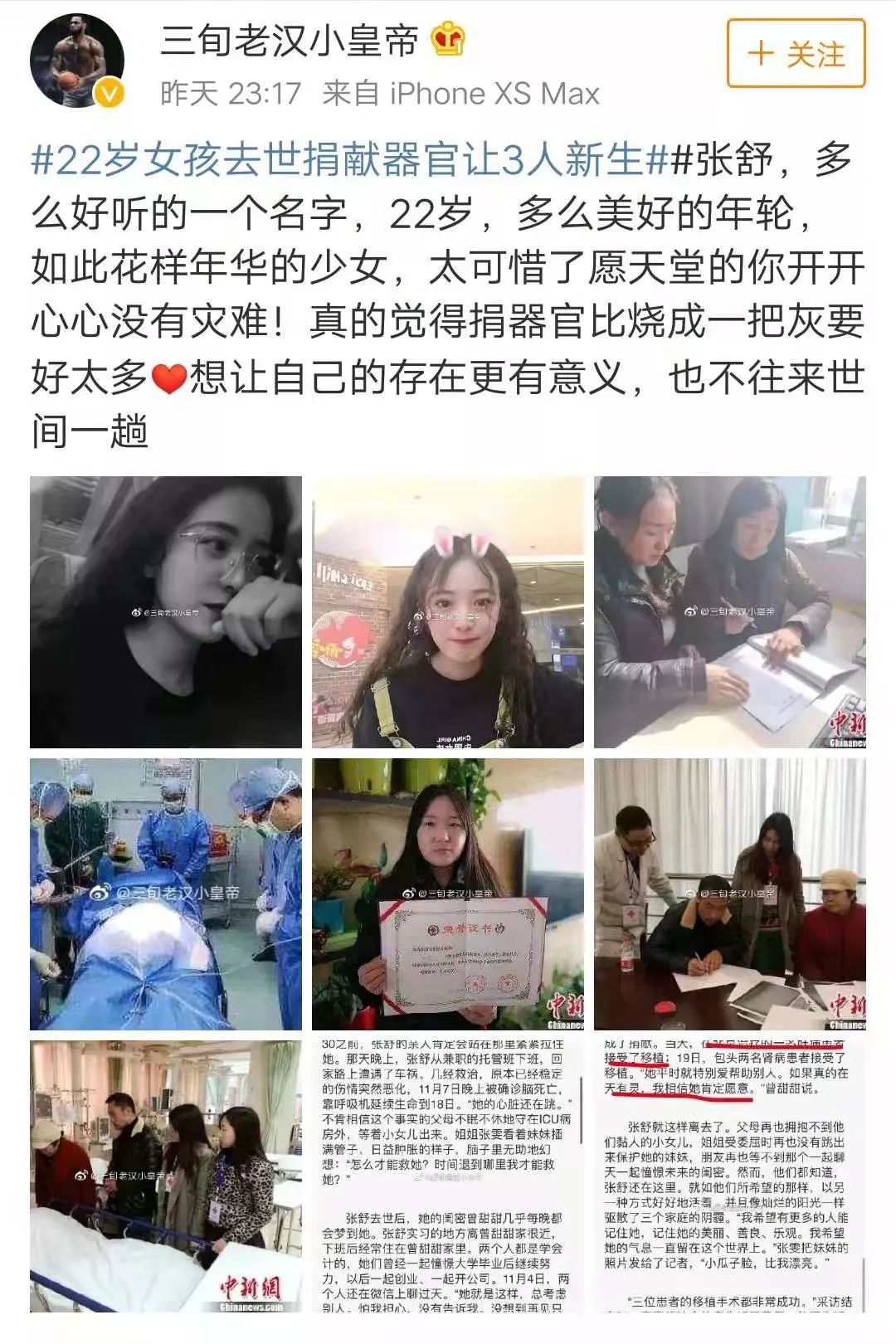 临河22岁女孩去世,捐献器官让3人新生_张舒