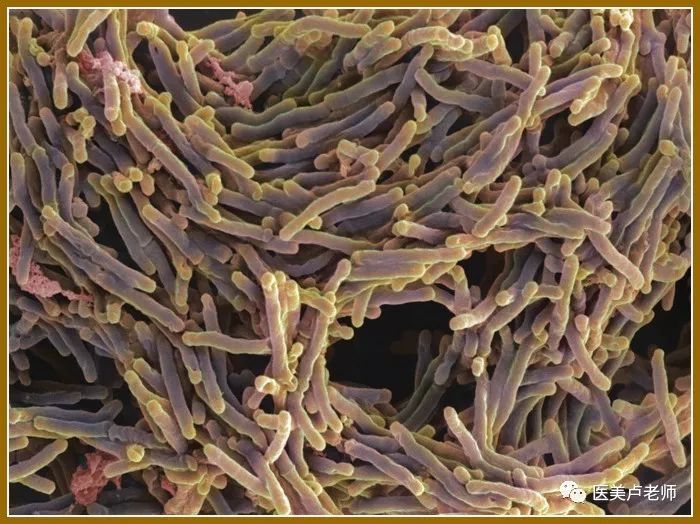 非结核分枝杆菌与整形美容术