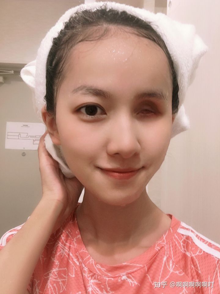 广东最美独眼女孩没什么大不了因为一只眼也能做得很好