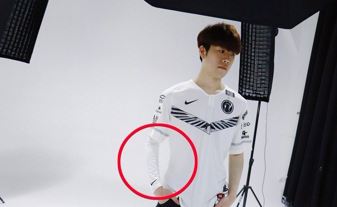 theshy手伤有多严重?shy哥直播透露可以免兵役