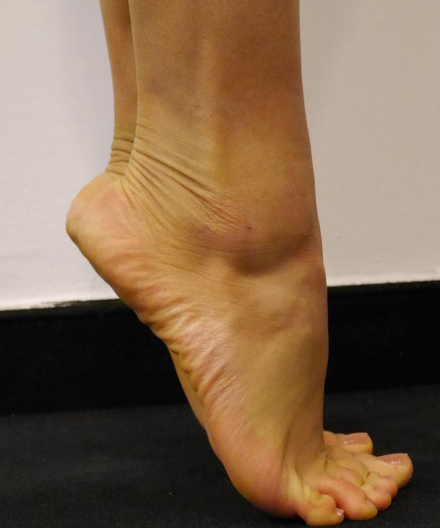 安全运动离不开灵活的脚趾头