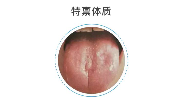 花剥苔病机图片