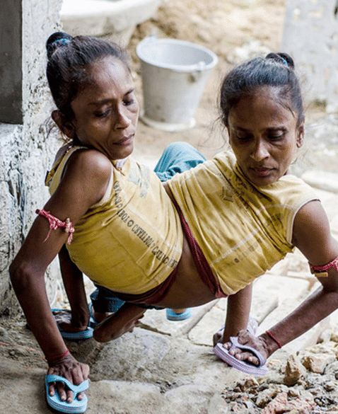 原创那对印度连体姐妹花吗?嫁给了同一个男人后,三个人婚后生活如何