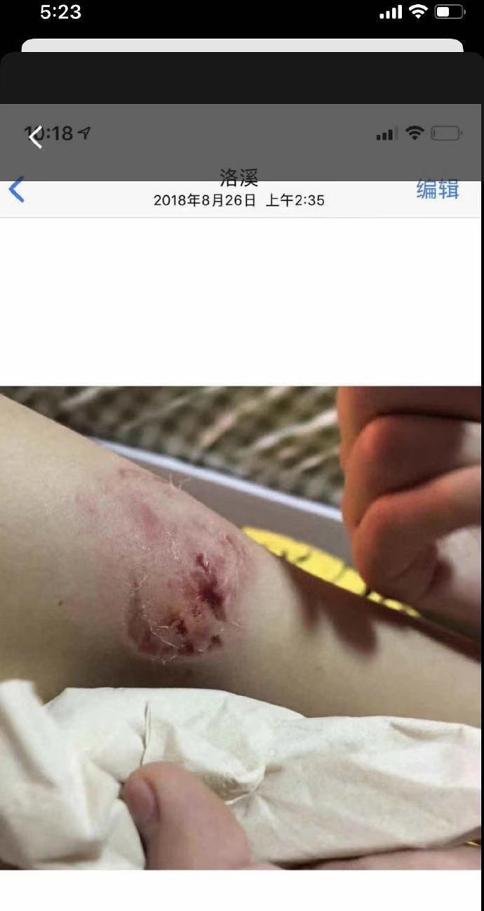 女团cp闹掰,互殴被曝吓人伤口,cp站关闭,据悉不止一对cp打过架