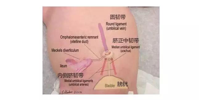 肚脐眼里老是有黑乎乎的"泥",能不能直接抠掉?