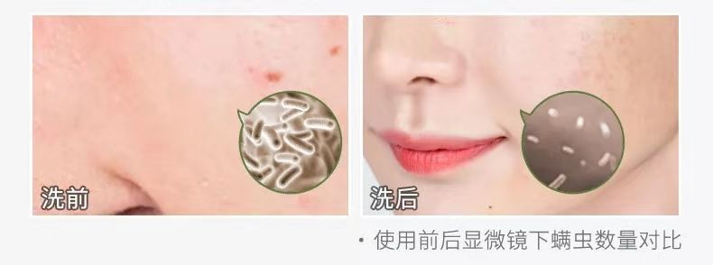 晒被子10次,比不上用它喷一回!高效除螨