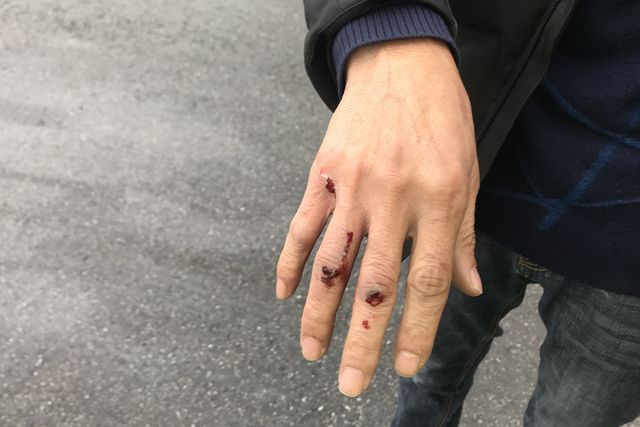 萧山高速上飞来一枚"子弹",挡风玻璃被直接砸穿.