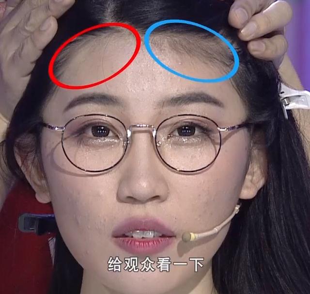 额头窄适合留刘海吗额头窄适合什么发型看完这篇你就知道了