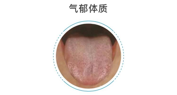 你对应的是哪个_舌苔