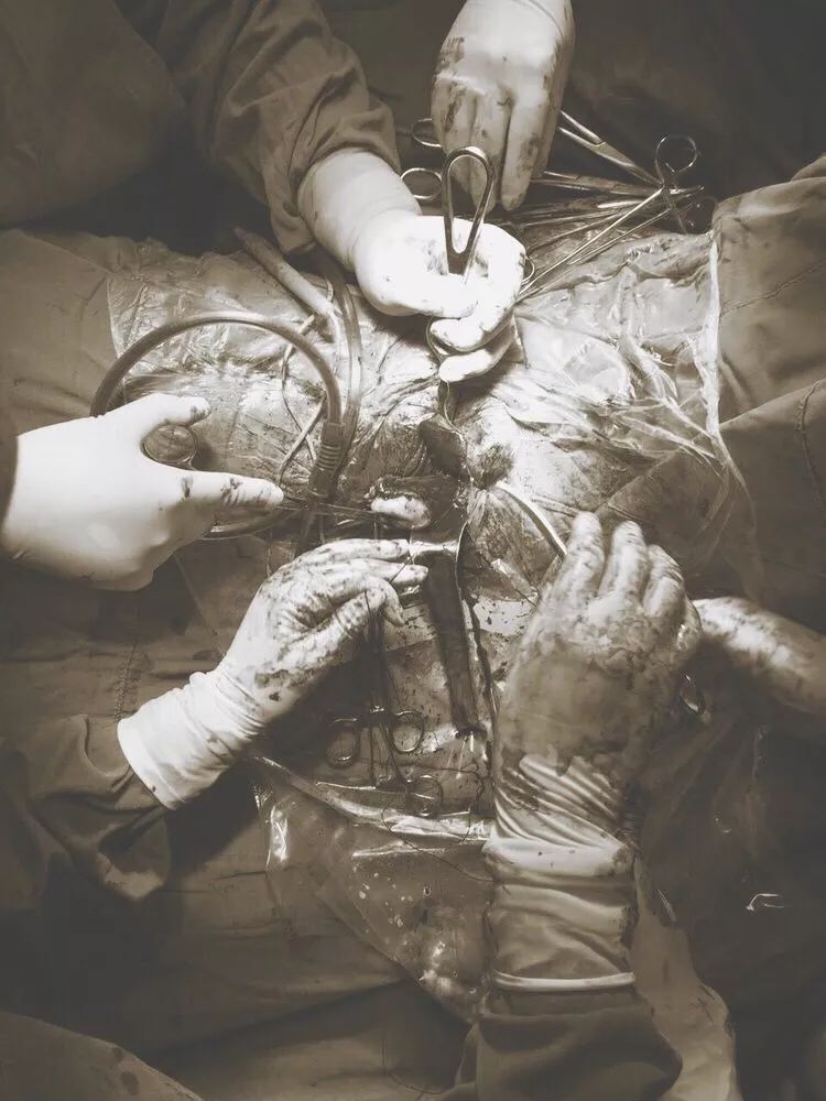 淄博市中医医院顺利开展无匙孔的手术阴式手术