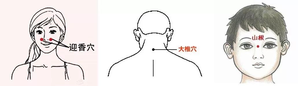 但相对来说,贴在  后颈大椎穴 更不影响面容, 对于 爱美的妹纸 来说