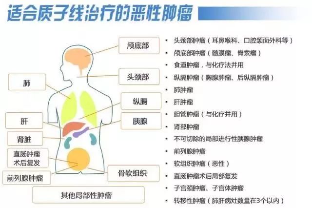 全球癌症治疗 日本东京最牛 以满分位居榜首 质子