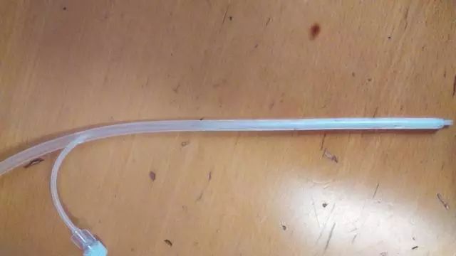 一文读懂胃肠外科常见的术后早期并发症_腹腔