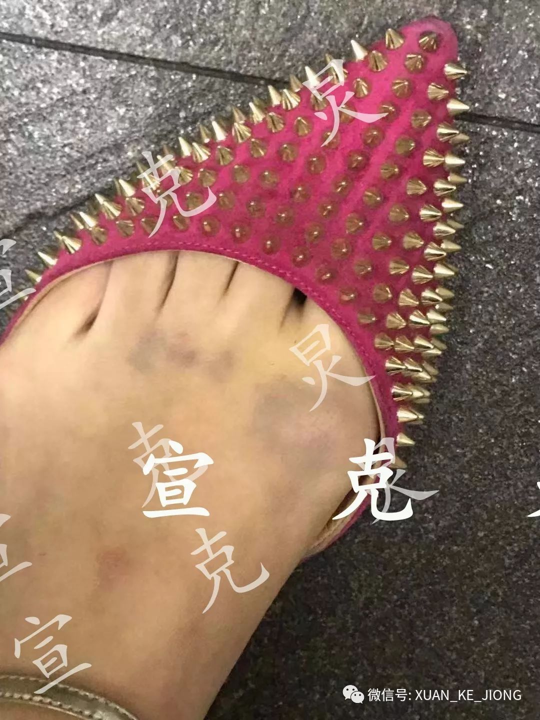 强行揉搓,到10楼才松手没想到接着又被他捏住脚狠狠踩掉鞋,脚被踩得