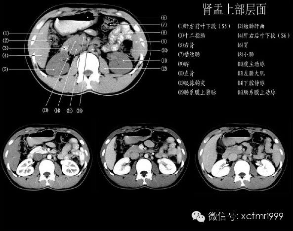 肝脏分段ct解剖图图片