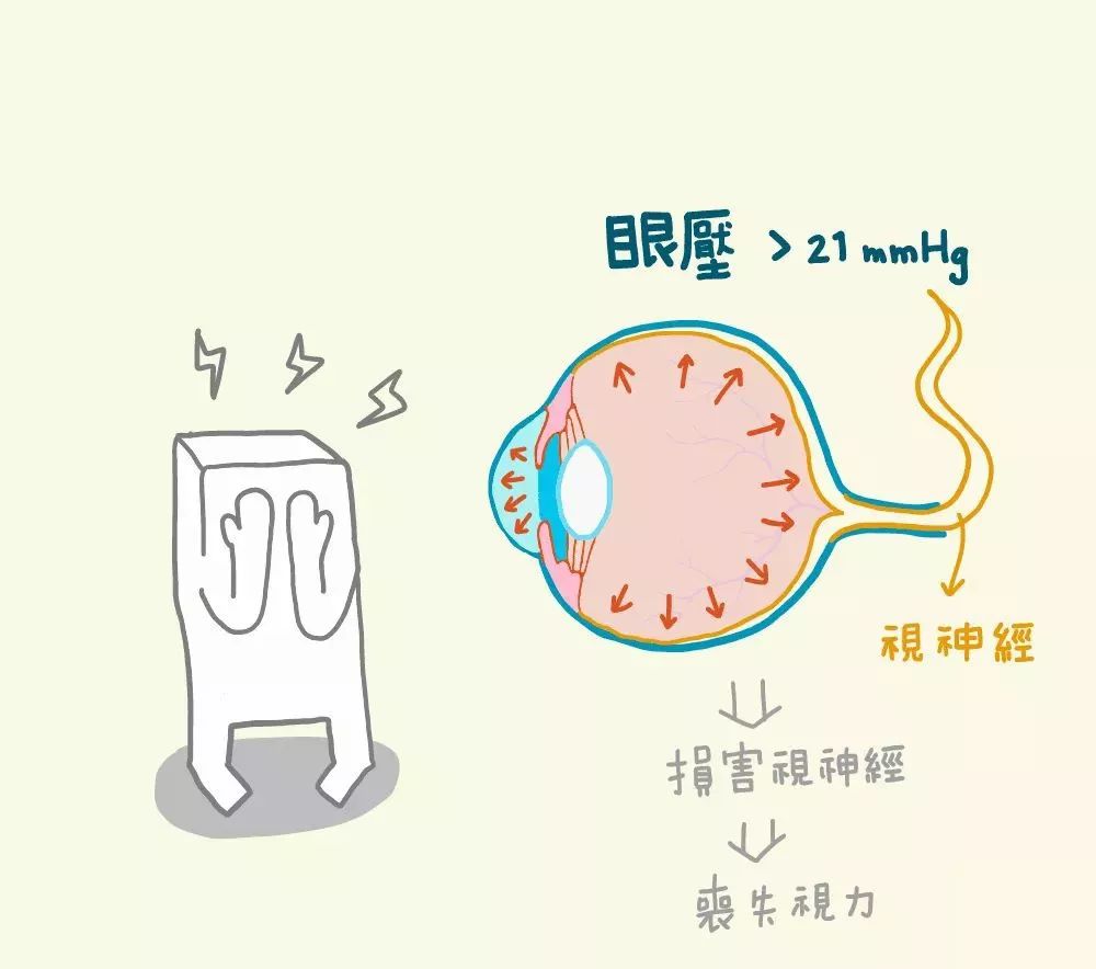 眼压高很麻烦 有些症状你意想不到 眼球