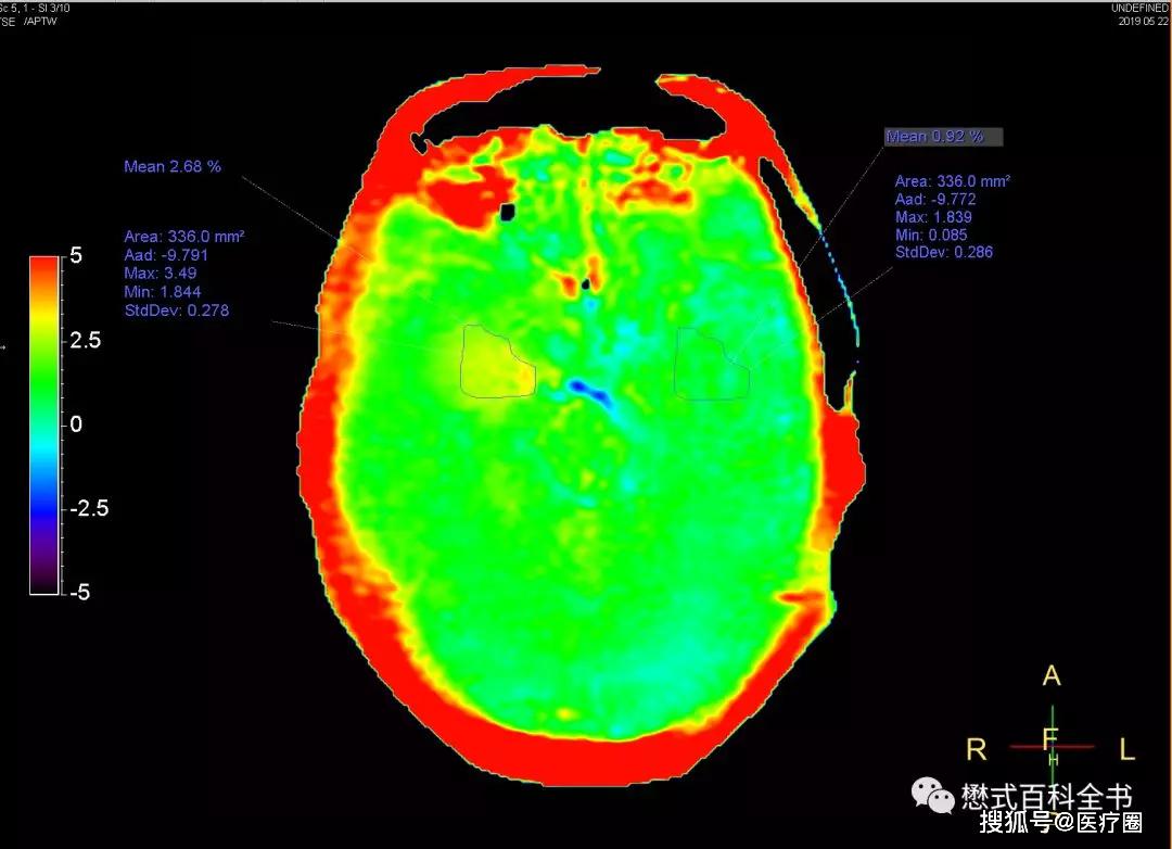 穷人的分子影像学apt
