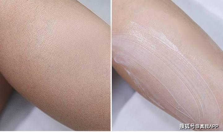 涂完身体乳起小疙瘩怎么回事(涂完身体乳起小疙瘩怎么回事儿)