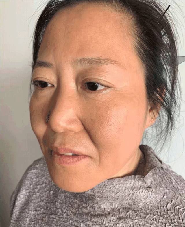 睡前用这颗蛋,色斑暗沉消失了,连暗沉大毛孔都没了!