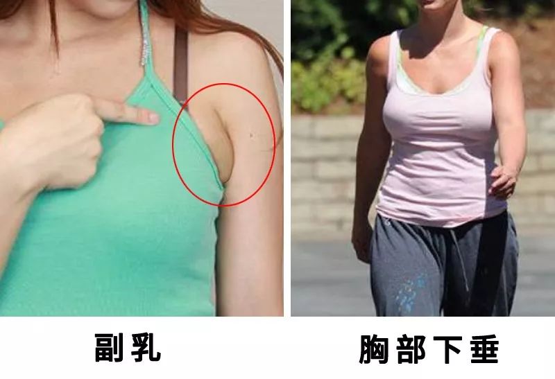 没生孩子女性乳房图片