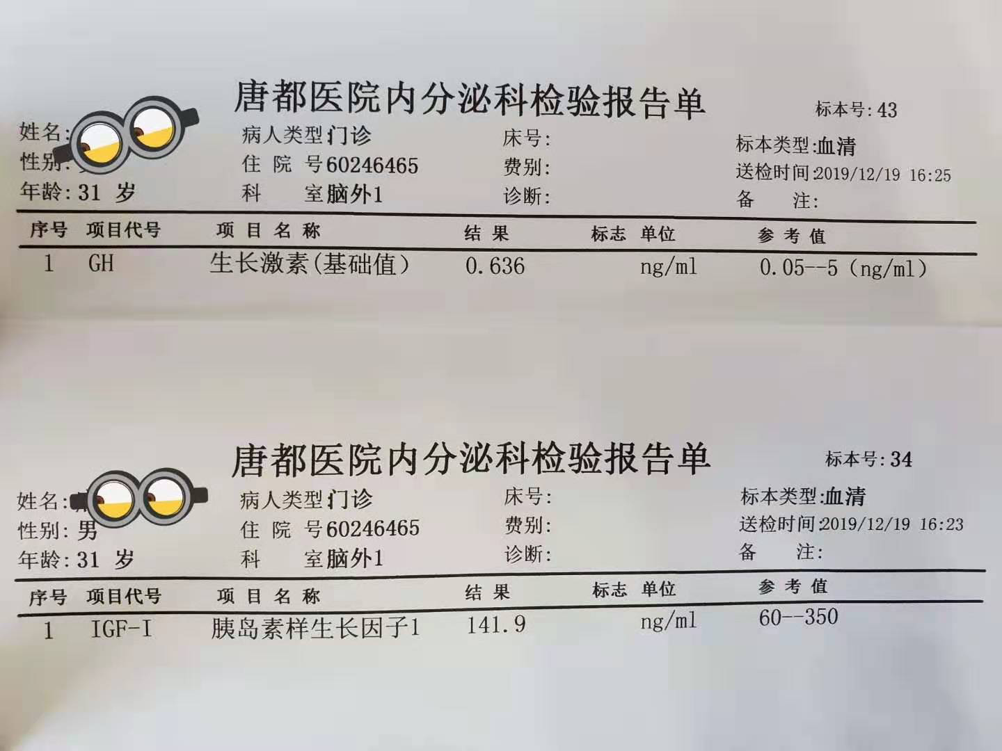 帅小伙容貌巨变,祸因小小的垂体瘤!