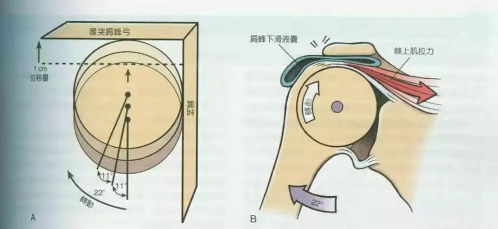 肩峰撞击试验图片