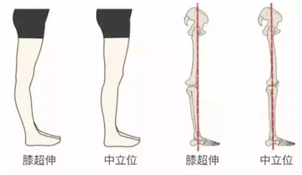 正常膝关节伸直图片图片