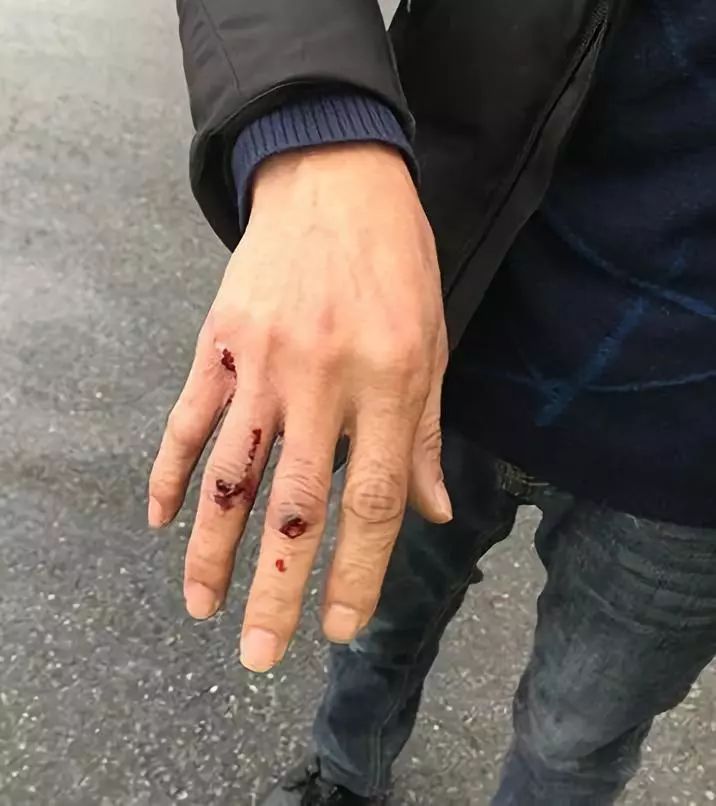 杭州惊恐开车在高速公路上一颗子弹飞了过来