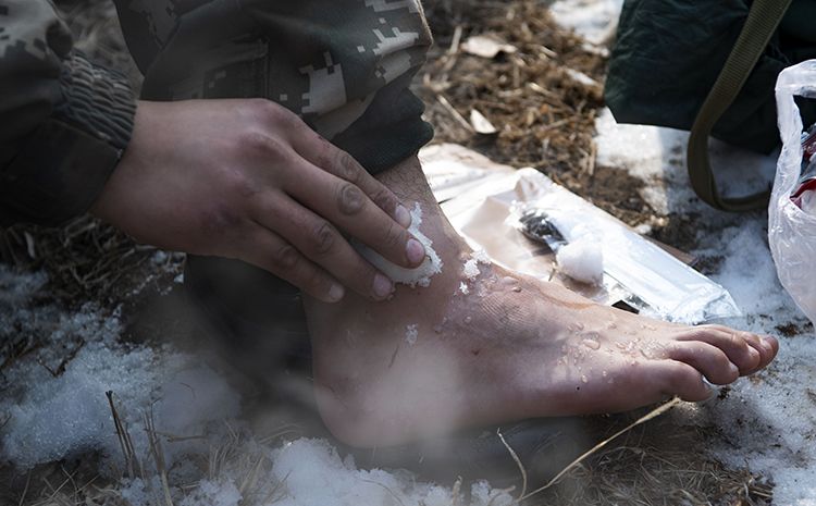 为了坚持完成训练,休息间隙用地面未化的积雪冰敷,消肿止痛