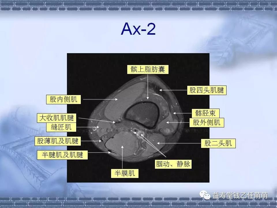 膝關節解剖講解