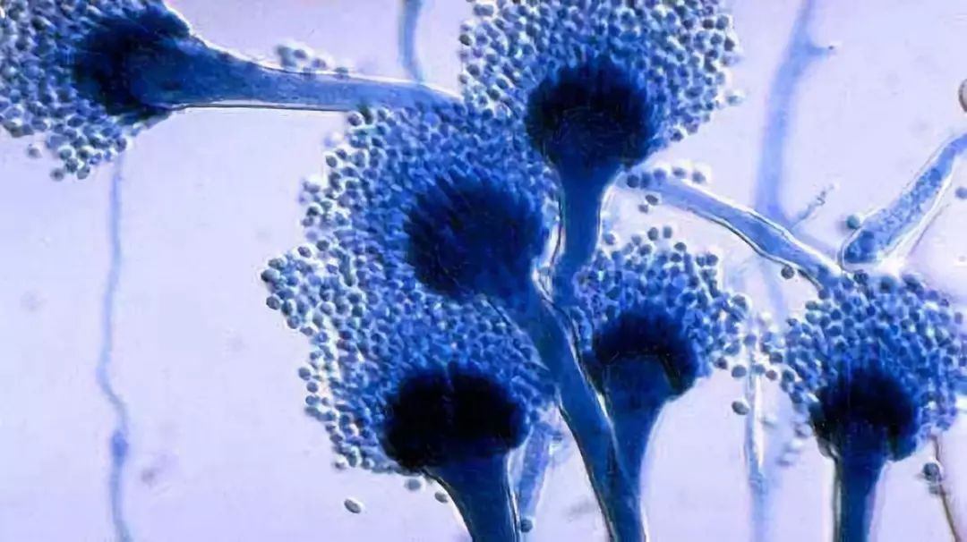 毛霉菌病毒图片图片