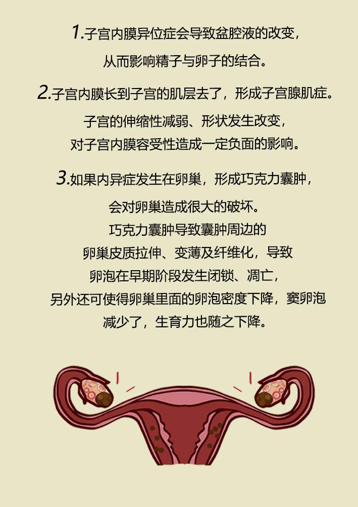 子宫性不育有哪些症状给大家做详细解答一子宫发育不良指青春期后子宫