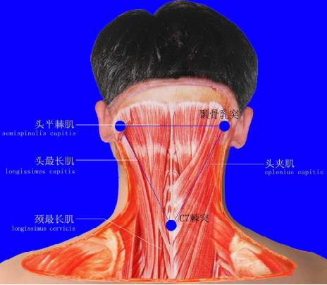头夹肌为颈部中层肌肉构成的筋肌筋膜立体三角区,其应力点位于枕外隆